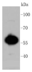 Western blot analysis of AKT1/2/3 on MCF-7 cell lysates using anti-AKT1/2/3 antibody at 1/1,000 dilution.