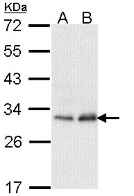 Phosphomannomutase 2 antibody