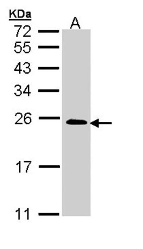 TC21 antibody