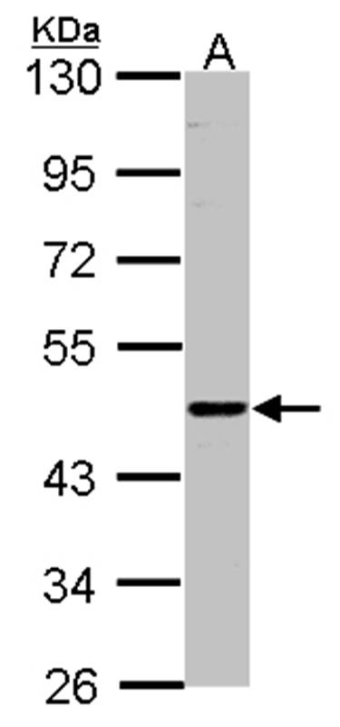 ENTPD6(CD39L2) antibody