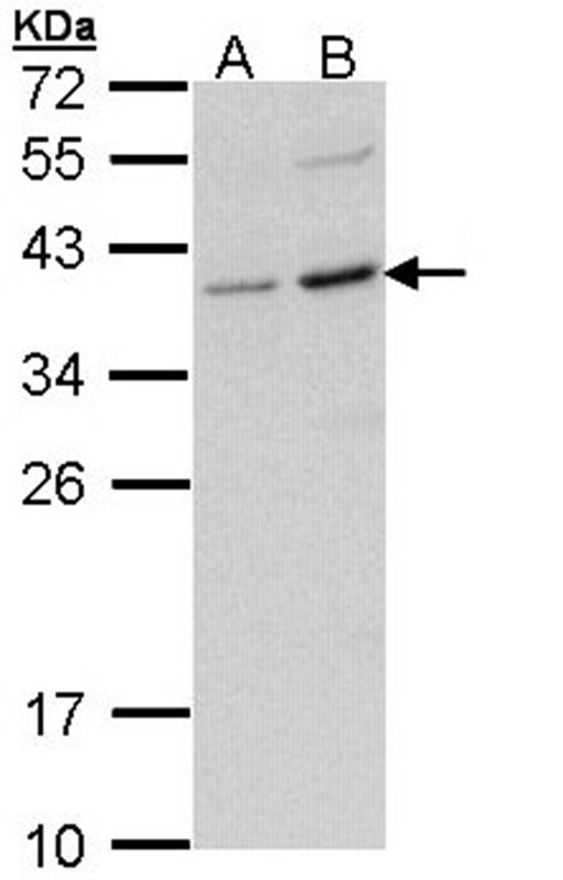 CD272 antibody
