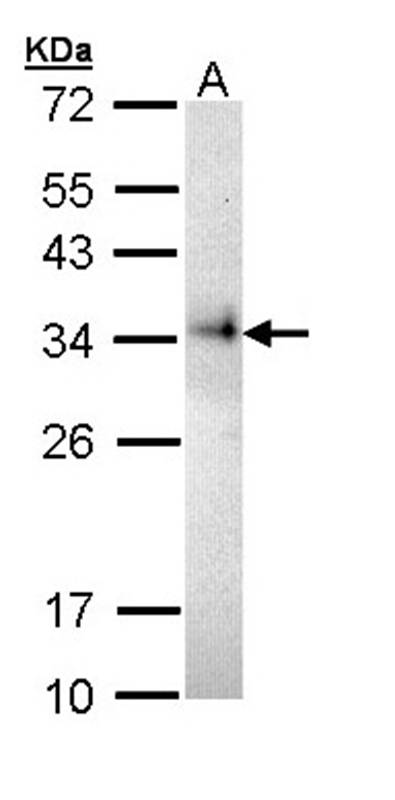 CD74 antibody