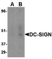 DC-SIGN Monoclonal Antibody