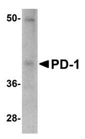 PD-1 Monoclonal Antibody