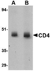 CD4 Monoclonal Antibody