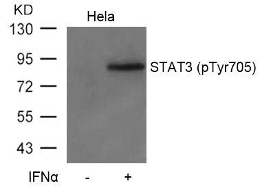 STAT3(Phospho-Tyr705) Antibody