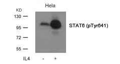 STAT6(Phospho-Tyr641) Antibody