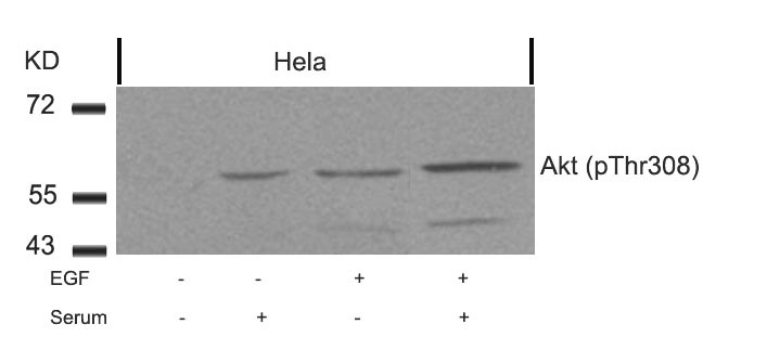 Akt(Phospho-Thr308) Antibody