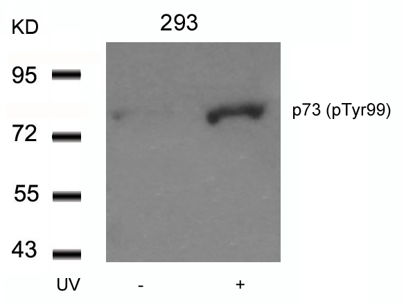 p73(Phospho-Tyr99) Antibody