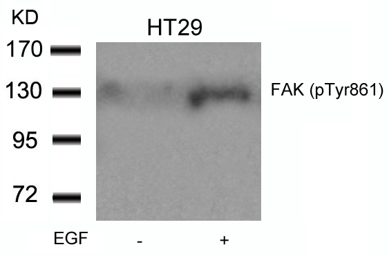 FAK(Phospho-Tyr861) Antibody