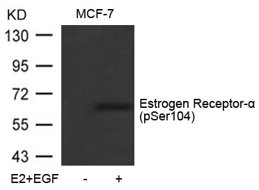 Estrogen Receptor-a(Phospho-Ser104) Antibody