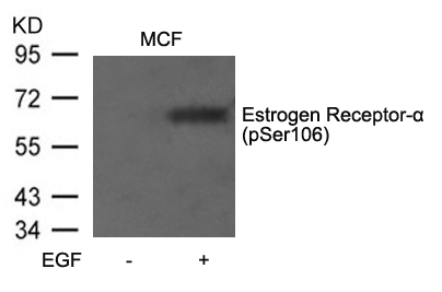 Estrogen Receptor-a(Phospho-Ser106) Antibody