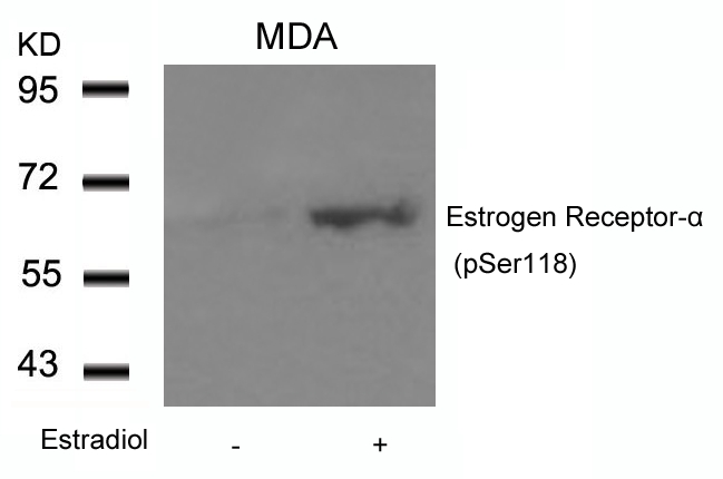 Estrogen Receptor-a(Phospho-Ser118) Antibody