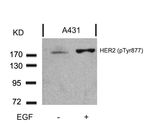 HER2(Phospho-Tyr877) Antibody