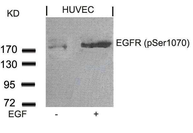 EGFR(Phospho-Ser1070) Antibody