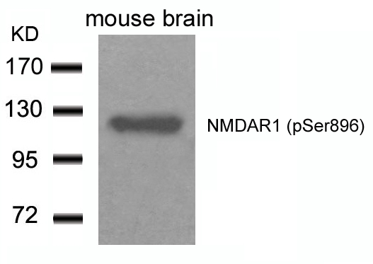 NMDAR1(Phospho-Ser896) Antibody