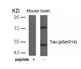 Tau(Phospho-Ser214) Antibody