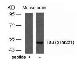 Tau(Phospho-Thr231) Antibody