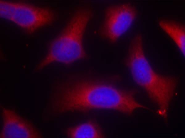 Tau(Phospho-Ser262) Antibody