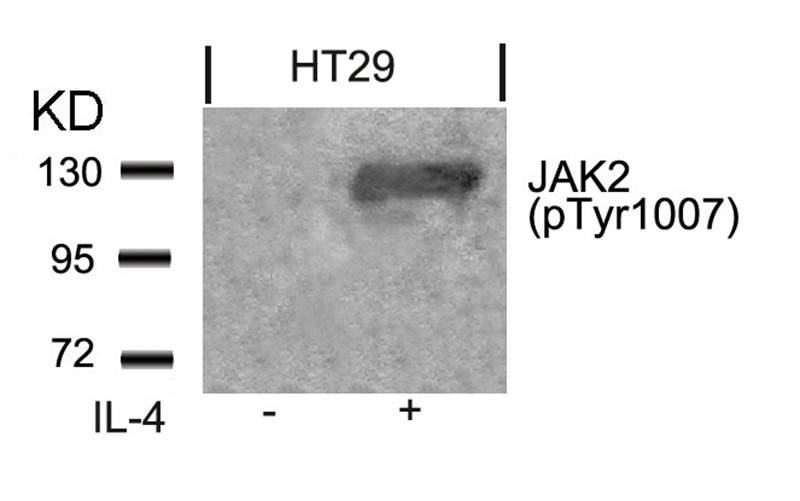 Jak2(Phospho-Tyr1007) Antibody