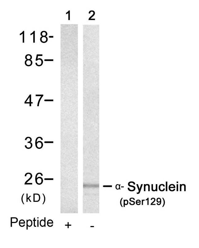 a-Synuclein(Phospho-Ser129) Antibody