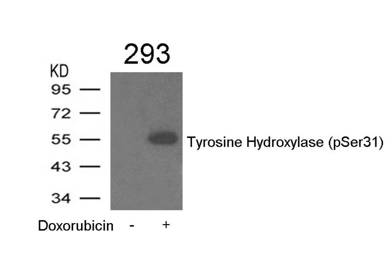Tyrosine Hydroxylase(Phospho-Ser31) Antibody