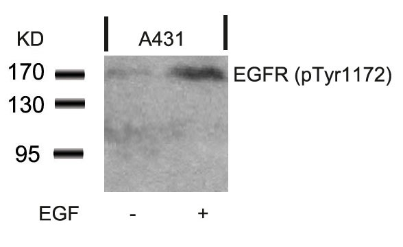 EGFR(Phospho-Tyr1172) Antibody