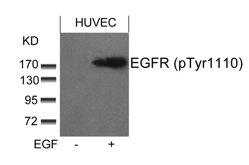 EGFR(phospho-Tyr1110) Antibody