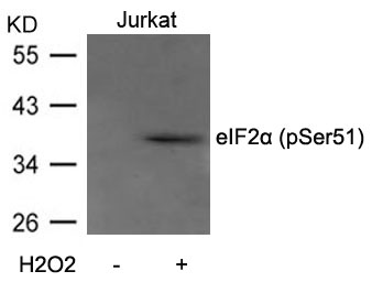 eIF2a(Phospho-Ser51) Antibody