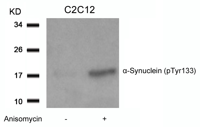 a-Synuclein(Phospho-Tyr133) Antibody
