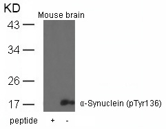 a-Synuclein(Phospho-Tyr136) Antibody