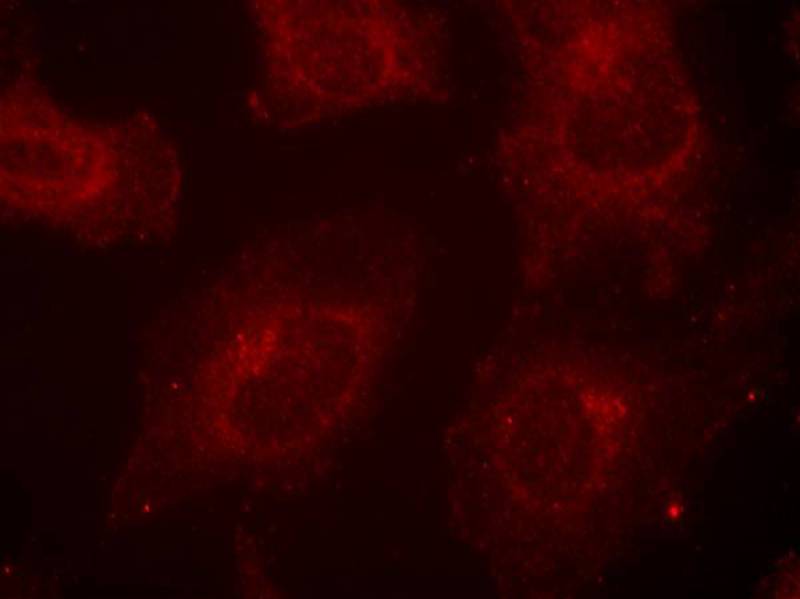 Gab1(Phospho-Tyr627) Antibody
