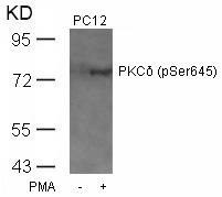 PKCd(Phospho-Ser645) Antibody