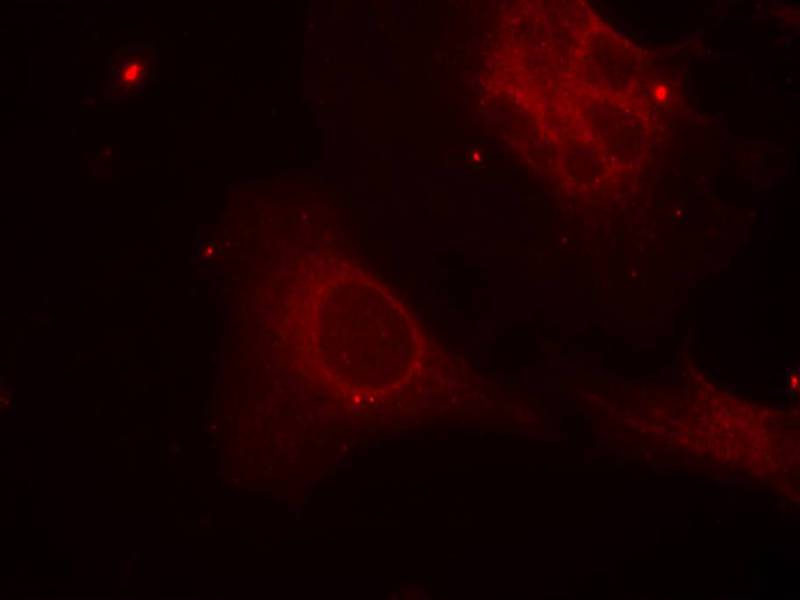 Shc1(Phospho-Tyr349) Antibody