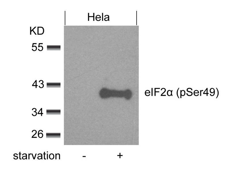 eIF2a(phospho-Ser49) Antibody