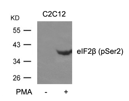 eIF2b(phospho-Ser2) Antibody