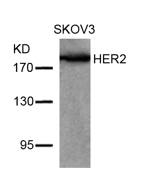 HER2(Ab-877) Antibody