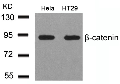 b-Catenin(Ab-41/45) Antibody
