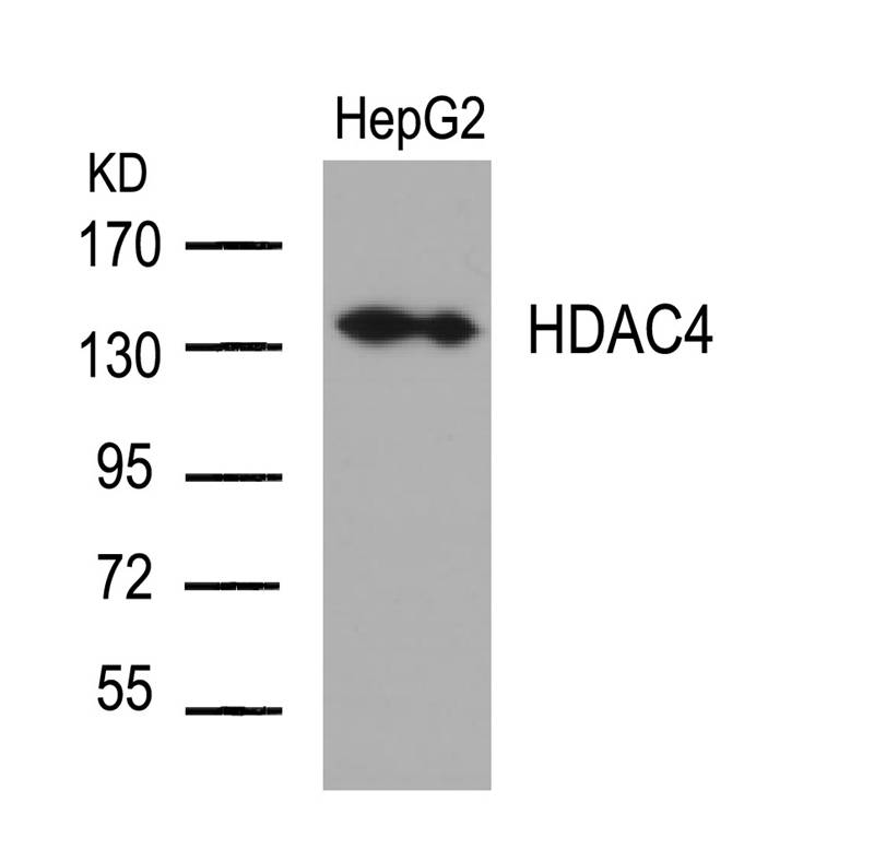 HDAC4(Ab-632) Antibody