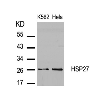 HSP27(Ab-82) Antibody