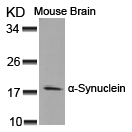 a-Synuclein(Ab-125) Antibody