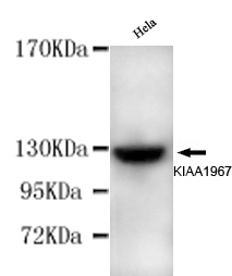 KIAA1967 Monoclonal Antibody