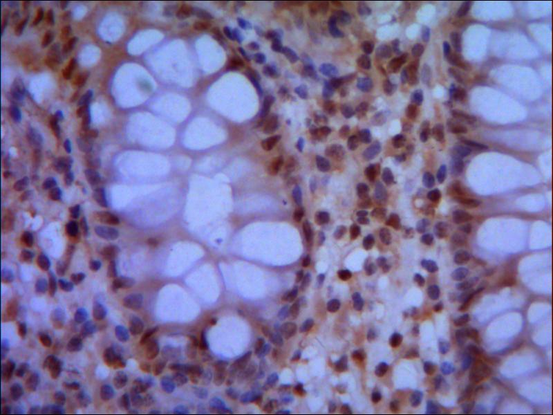SMC1A(N-term) Monoclonal Antibody