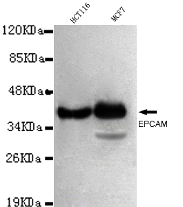 EPCAM Monoclonal Antibody