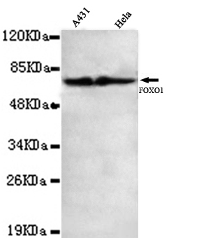 FOXO1 Monoclonal Antibody