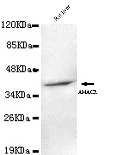 AMACR(C-term) Monoclonal Antibody
