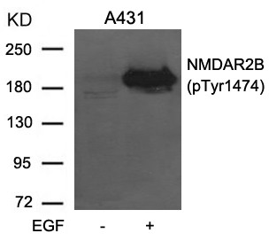 NMDAR2B(phospho-Tyr1474) Antibody