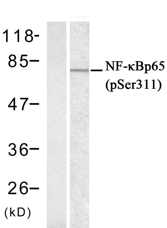 NFκB-p65(phospho-Ser311) Antibody