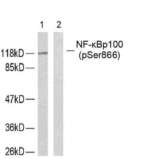 NFκB-p100(Phospho-Ser866) Antibody