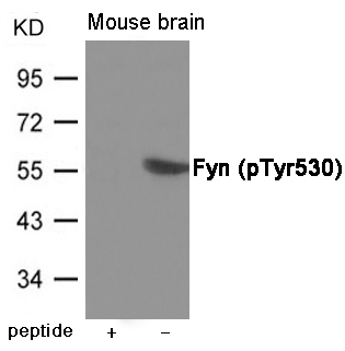 Fyn (Phospho-Tyr530) Antibody